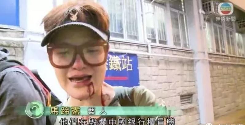 TVB爱国艺人被暴徒打伤