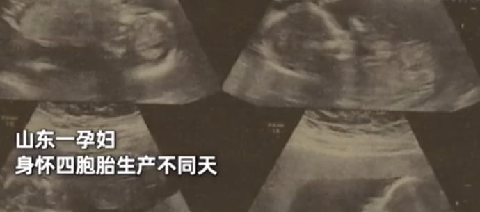 山东一孕妇身怀四胞胎生产不同天
